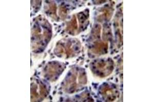 Image no. 3 for anti-Gastric Intrinsic Factor (Vitamin B Synthesis) (GIF) (AA 188-218), (Middle Region) antibody (ABIN952930)