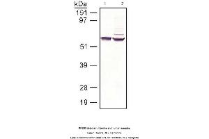 anti-Retinal Pigment Epithelium-Specific Protein 65kDa (RPE65) antibody