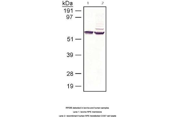 anti-Retinal Pigment Epithelium-Specific Protein 65kDa (RPE65) antibody