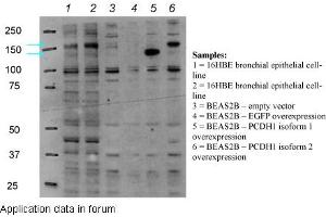 Image no. 3 for anti-Protocadherin 1 (PCDH1) (N-Term) antibody (ABIN2782181)