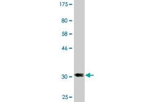 Western Blot detection against Immunogen (31.