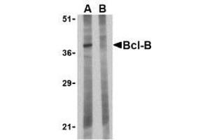 Image no. 2 for anti-BCL2-Like 10 (Apoptosis Facilitator) (BCL2L10) (N-Term) antibody (ABIN499431)
