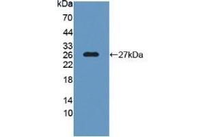 Image no. 3 for anti-Synaptosomal-Associated Protein, 25kDa (SNAP25) (AA 1-206) antibody (ABIN5662311)