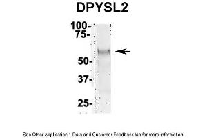 Image no. 2 for anti-Dihydropyrimidinase-Like 2 (DPYSL2) (Middle Region) antibody (ABIN2784711)