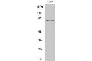 Image no. 1 for anti-MRE11 Meiotic Recombination 11 Homolog A (S. Cerevisiae) (MRE11A) (Ser916) antibody (ABIN3185627)