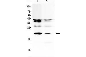 Image no. 1 for anti-Interleukin 11 (IL11) (AA 25-199) antibody (ABIN5519008)