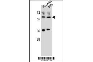 Image no. 3 for anti-Wilms Tumor 1 Interacting Protein (WTIP) (C-Term) antibody (ABIN2494169)