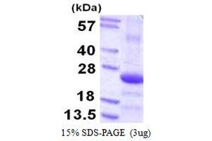 Image no. 1 for COP9 Signalosome Subunit 8 (COPS8) (AA 1-209) protein (His tag) (ABIN667600)