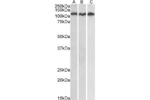 Image no. 2 for anti-ADAM Metallopeptidase Domain 17 (ADAM17) (C-Term) antibody (ABIN184721)