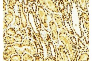 Image no. 4 for anti-V-Erb-A erythroblastic Leukemia Viral Oncogene Homolog 4 (Avian) (ERBB4) (pTyr1284) antibody (ABIN6256632)