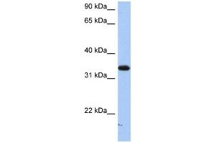 SULT6B1 抗体  (C-Term)