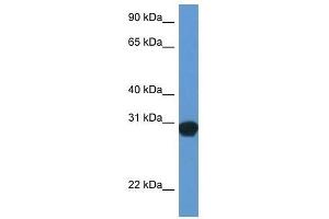 Image no. 1 for anti-Synaptosomal-Associated Protein, 29kDa (SNAP29) (Middle Region) antibody (ABIN929260)