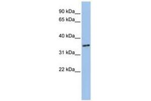 Image no. 1 for anti-PHD Finger Protein 13 (PHF13) (AA 36-85) antibody (ABIN6741099)