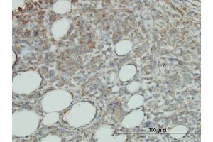 Image no. 1 for anti-Protein C Receptor, Endothelial (PROCR) (AA 1-238) antibody (ABIN564600)