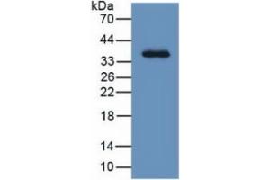 Image no. 3 for Leucine-Rich alpha-2 Glycoprotein 1 (LRG1) ELISA Kit (ABIN6730911)