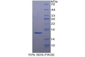 Image no. 1 for Corticotropin Releasing Hormone (CRH) protein (ABIN1170244)
