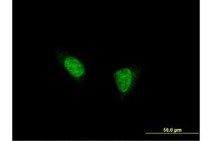 Immunofluorescence of monoclonal antibody to TSHZ1 on HeLa cell.
