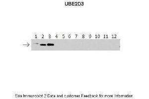 Image no. 6 for anti-Ubiquitin-Conjugating Enzyme E2D 3 (UBE2D3) (N-Term) antibody (ABIN2775674)