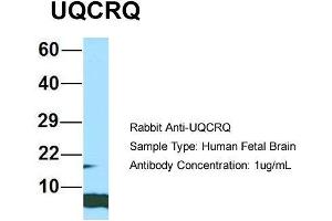Image no. 4 for anti-Ubiquinol-Cytochrome C Reductase, Complex III Subunit VII, 9.5kDa (UQCRQ) (Middle Region) antibody (ABIN2790714)