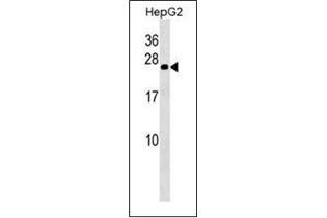 Image no. 1 for anti-Crystallin, gamma B (CRYGB) (AA 67-97), (Middle Region) antibody (ABIN952455)