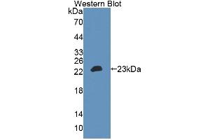 anti-Megakaryocyte-Associated tyrosine Kinase (MATK) (AA 1-173) antibody