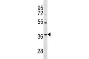 Image no. 2 for anti-ORAI Calcium Release-Activated Calcium Modulator 3 (ORAI3) (AA 1-30) antibody (ABIN3028905)