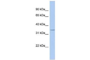 Image no. 1 for anti-Fat Storage-Inducing Transmembrane Protein 1 (FITM1) (Middle Region) antibody (ABIN635656)