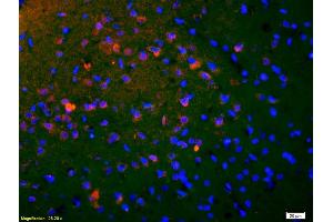 Image no. 6 for anti-cAMP Responsive Element Binding Protein 1 (CREB1) (pSer133) antibody (ABIN723980)