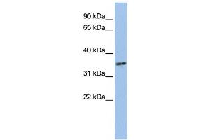 Image no. 1 for anti-PHD Finger Protein 13 (PHF13) antibody (ABIN2459472)