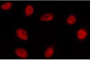 Image no. 1 for anti-Empty Spiracles Homeobox 1 (EMX1) (Internal Region) antibody (ABIN6259307)