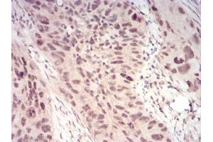 Image no. 8 for anti-Wilms Tumor 1 Associated Protein (WTAP) (AA 91-201) antibody (ABIN5542407)