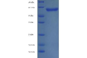 Image no. 1 for Neurofilament, Light Polypeptide (NEFL) (AA 2-543) protein (His tag) (ABIN5713696)