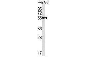 Image no. 2 for anti-UDP-Glucose 6-Dehydrogenase (UGDH) (AA 464-494), (C-Term) antibody (ABIN955441)