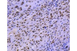Image no. 3 for anti-Histone Deacetylase 8 (HDAC8) antibody (ABIN5557483)