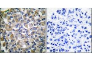 Image no. 3 for anti-Heat Shock 70kDa Protein 9 (Mortalin) (HSPA9) (AA 630-679) antibody (ABIN1533297)