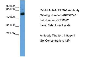 Image no. 3 for anti-Aldehyde Dehydrogenase 3 Family, Member A1 (ALDH3A1) (C-Term) antibody (ABIN2788191)