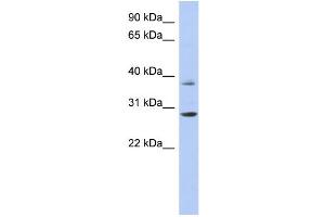 Image no. 1 for anti-Homeobox C5 (HOXC5) (Middle Region) antibody (ABIN2781078)