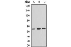 Image no. 1 for anti-Trk-Fused Gene (TFG) (full length) antibody (ABIN6005672)
