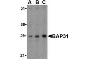 Image no. 1 for anti-B-Cell Receptor-Associated Protein 31 (BCAP31) (Middle Region) antibody (ABIN1030882)