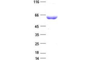 Image no. 1 for Stress-Induced-phosphoprotein 1 (STIP1) protein (DYKDDDDK Tag) (ABIN2732856)