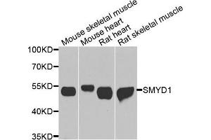Image no. 1 for anti-SET and MYND Domain Containing 1 (SMYD1) antibody (ABIN4905244)