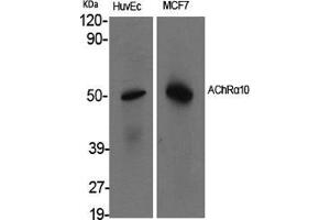 Image no. 2 for anti-Cholinergic Receptor, Nicotinic, alpha 10 (CHRNA10) (C-Term) antibody (ABIN3180471)