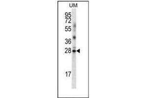 Image no. 2 for anti-LRRN4 C-terminal Like (LRRN4CL) (AA 124-154), (Middle Region) antibody (ABIN953237)
