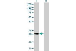 Image no. 6 for anti-Nucleolar Protein 16 (NOP16) (AA 1-178) antibody (ABIN526755)