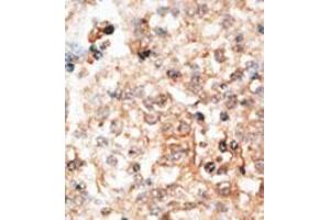 Image no. 2 for anti-Osteocalcin (BGLAP) (AA 9-39), (N-Term) antibody (ABIN357367)