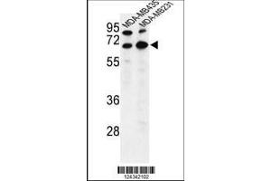 anti-Bestrophin 2 (BEST2) (AA 374-403), (C-Term) antibody