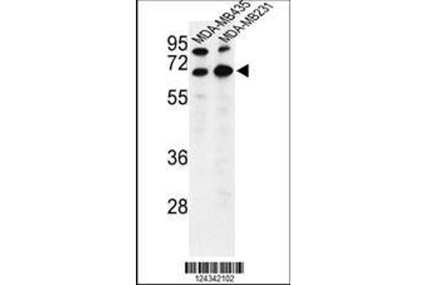 anti-Bestrophin 2 (BEST2) (AA 374-403), (C-Term) antibody