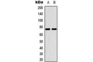 Image no. 2 for anti-Protein Inhibitor of Activated STAT, 4 (PIAS4) (C-Term) antibody (ABIN2705124)