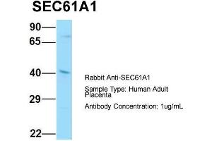 Image no. 1 for anti-Sec61 alpha 1 Subunit (SEC61A1) (C-Term) antibody (ABIN2790091)