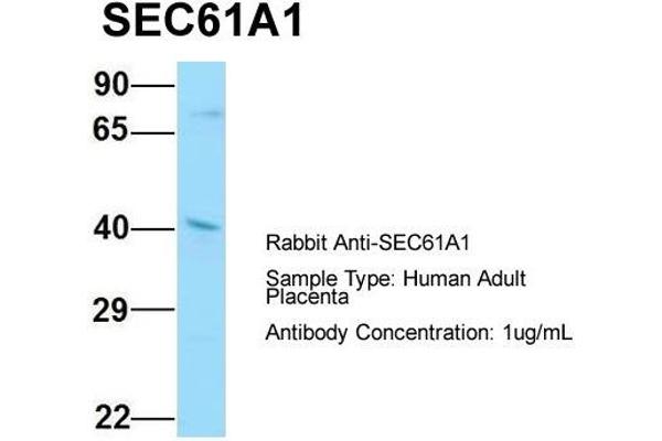 anti-Sec61 alpha 1 Subunit (SEC61A1) (C-Term) antibody
